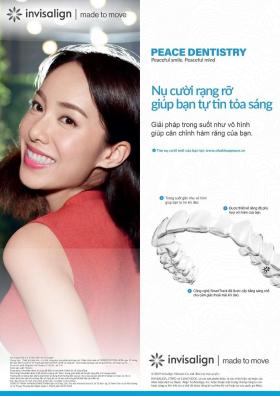 Nha khoa Peace Dentistry tư vấn, giải đáp về chỉnh nha Invisalign