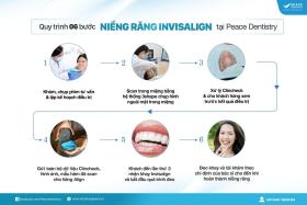 Nha khoa Peace Dentistry tư vấn, giải đáp về chỉnh nha Invisalign